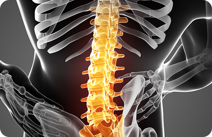 척추 통증 뼈 이미지